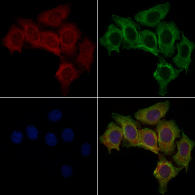 CSNK1A1L Antibody in Immunocytochemistry (ICC/IF)