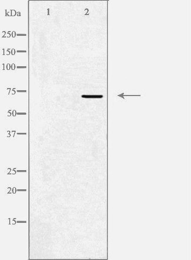 KV4.1 (KCND1) Antibody in Western Blot (WB)