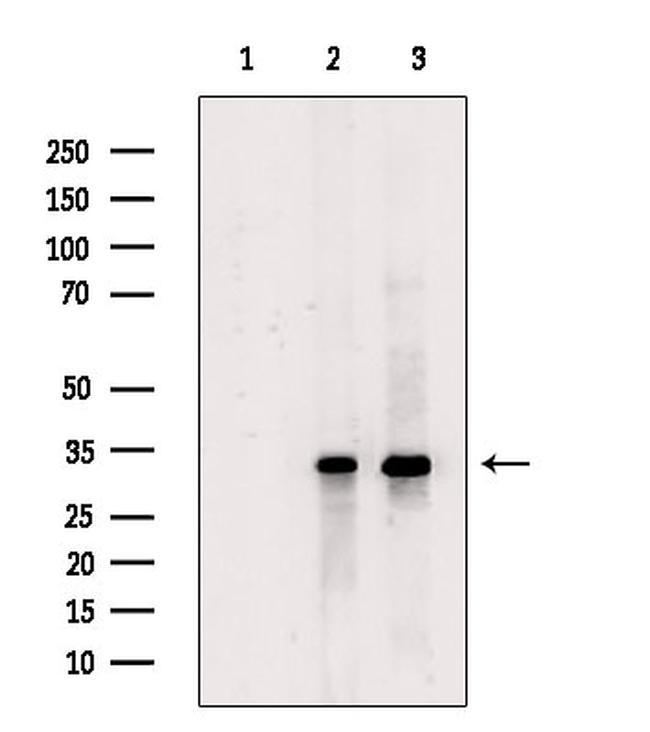 KCNMB3 Antibody in Western Blot (WB)