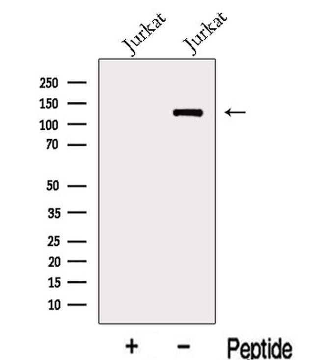 KDM2A Antibody in Western Blot (WB)
