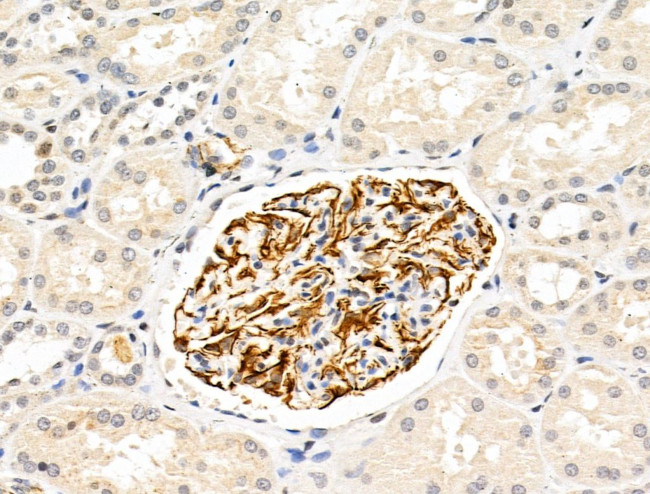 KIAA0701 Antibody in Immunohistochemistry (Paraffin) (IHC (P))