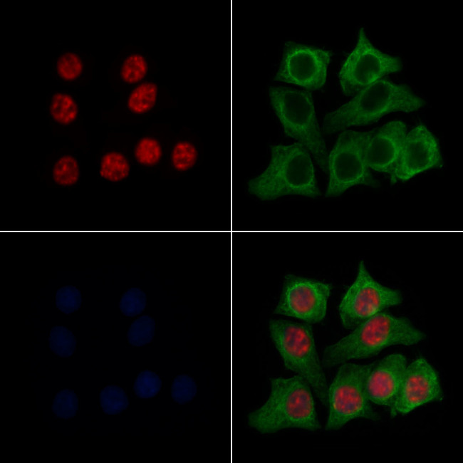 KLF5 Antibody in Immunocytochemistry (ICC/IF)