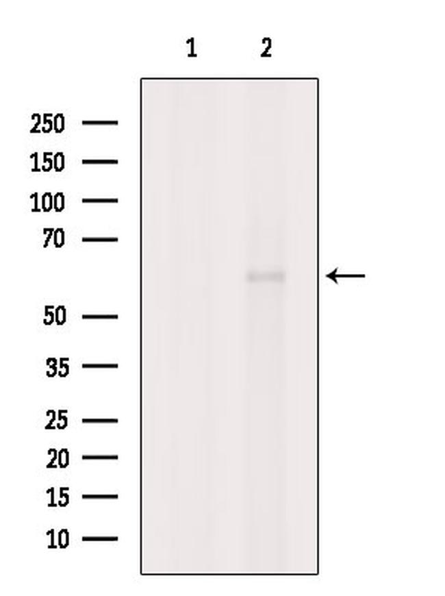 KPNA5 Antibody in Western Blot (WB)