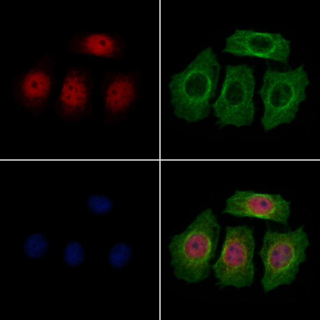 LAP2 Antibody in Immunocytochemistry (ICC/IF)