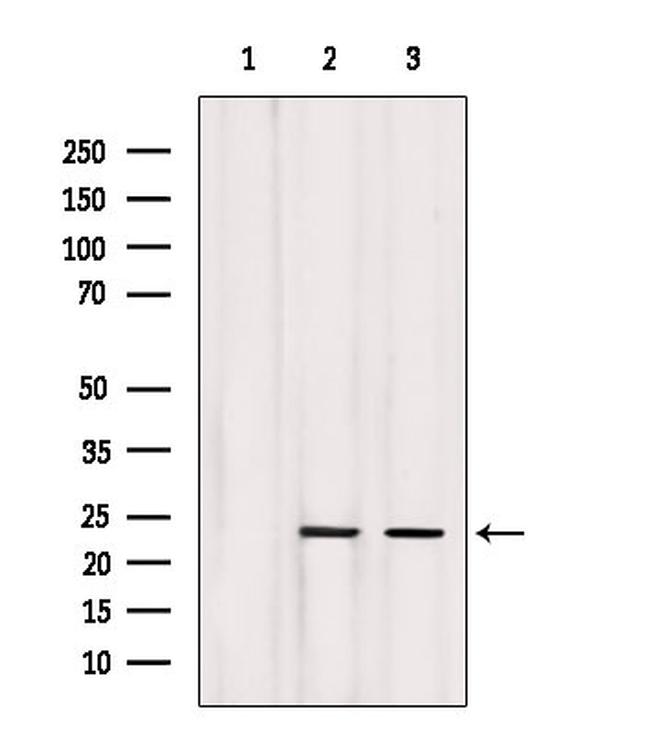 NGAL Antibody in Western Blot (WB)