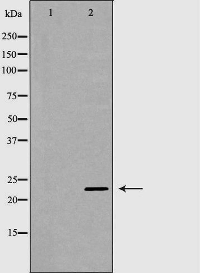 NGAL Antibody in Western Blot (WB)