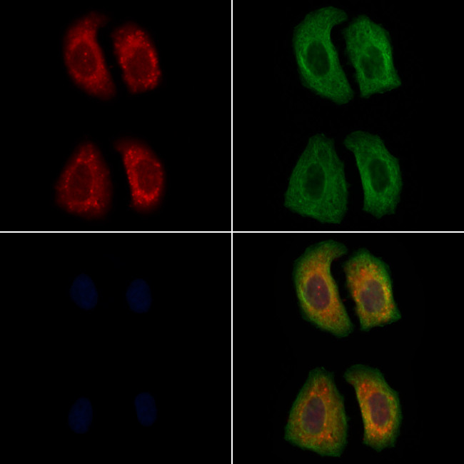 LHR Antibody in Immunocytochemistry (ICC/IF)