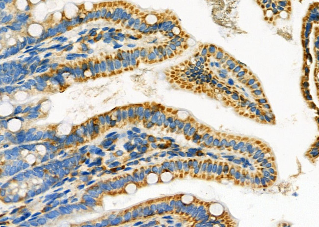 LRP1B Antibody in Immunohistochemistry (Paraffin) (IHC (P))