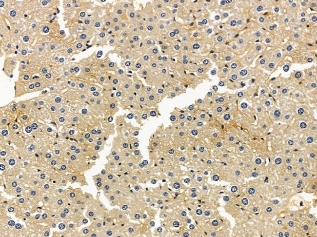 LSS Antibody in Immunohistochemistry (Paraffin) (IHC (P))