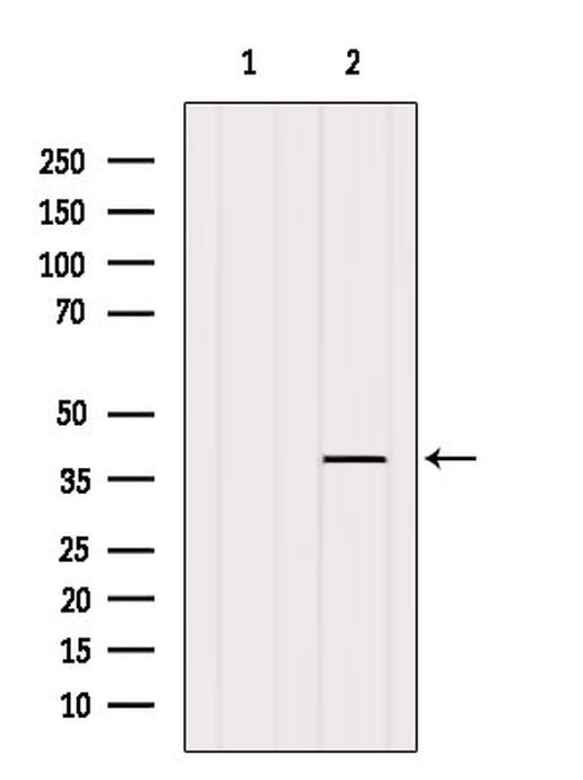 LTB4R Antibody in Western Blot (WB)