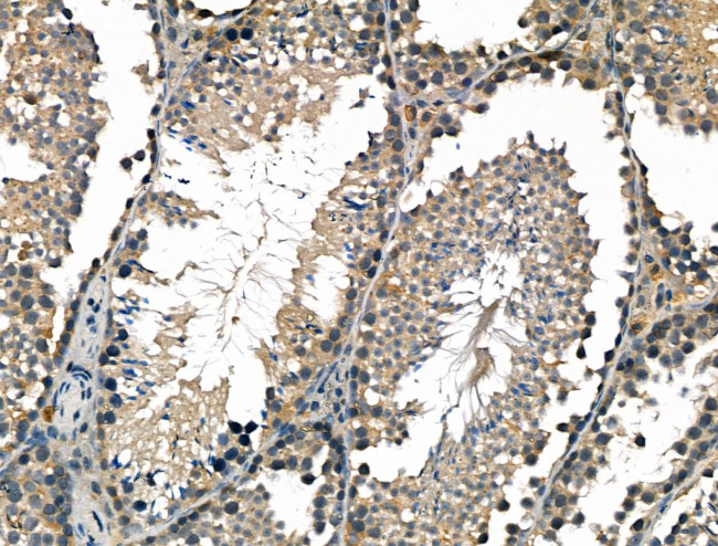LY6K Antibody in Immunohistochemistry (Paraffin) (IHC (P))