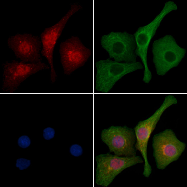 LZTR1 Antibody in Immunocytochemistry (ICC/IF)