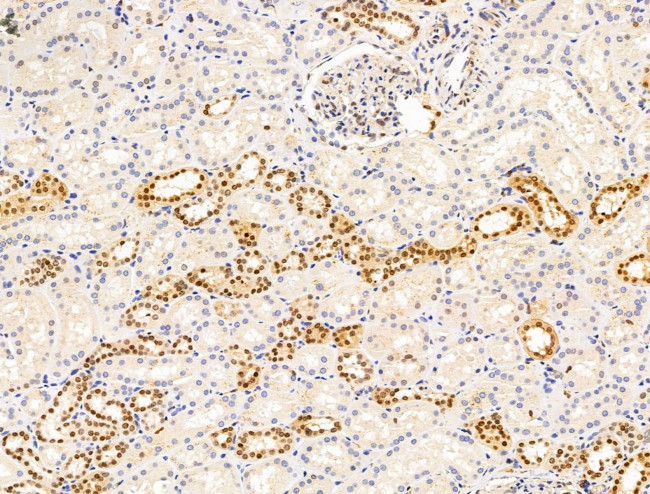 H2AFY2 Antibody in Immunohistochemistry (Paraffin) (IHC (P))