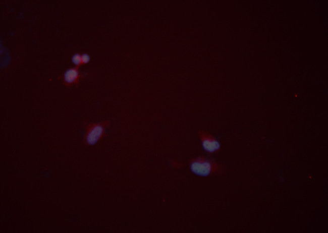 Monoamine Oxidase B Antibody in Immunocytochemistry (ICC/IF)