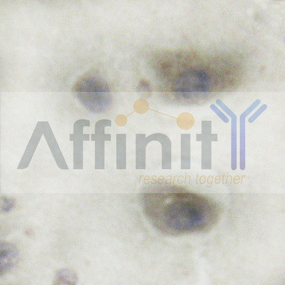 TPL2 Antibody in Immunohistochemistry (Paraffin) (IHC (P))