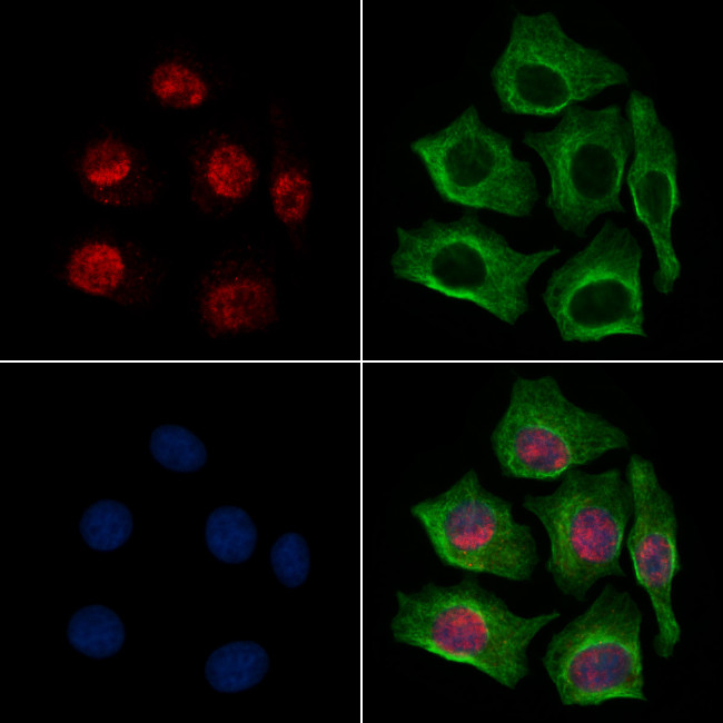 MAPKAPK3 Antibody in Immunocytochemistry (ICC/IF)