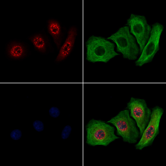 MAPKAPK2 Antibody in Immunocytochemistry (ICC/IF)