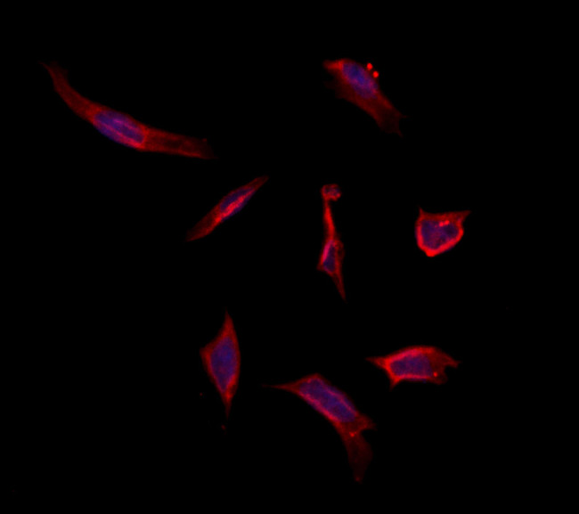 MAT1A Antibody in Immunocytochemistry (ICC/IF)