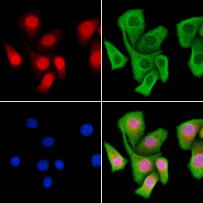 MEIS1 Antibody in Immunocytochemistry (ICC/IF)