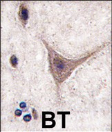 CDH10 Antibody in Immunohistochemistry (Paraffin) (IHC (P))