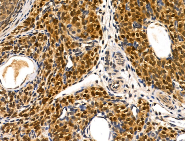 METTL1 Antibody in Immunohistochemistry (Paraffin) (IHC (P))