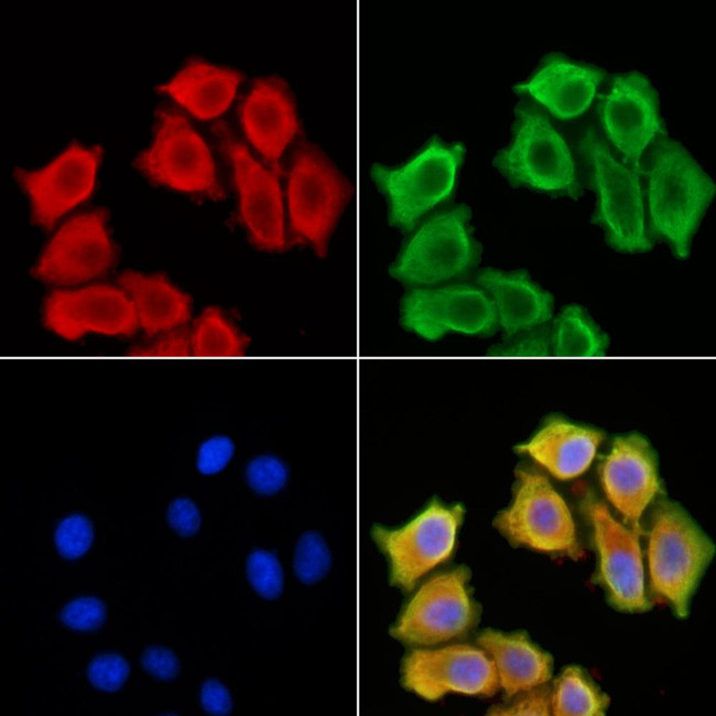 MGLL Antibody in Immunocytochemistry (ICC/IF)