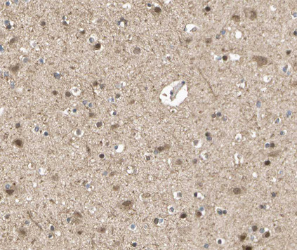 mGluR7 Antibody in Immunohistochemistry (Paraffin) (IHC (P))