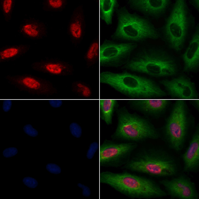 KMT2D Antibody in Immunocytochemistry (ICC/IF)