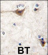 CDH10 Antibody in Immunohistochemistry (Paraffin) (IHC (P))