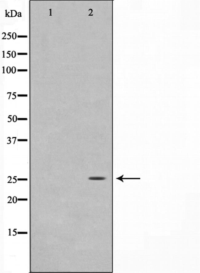 MOB1 Antibody in Western Blot (WB)