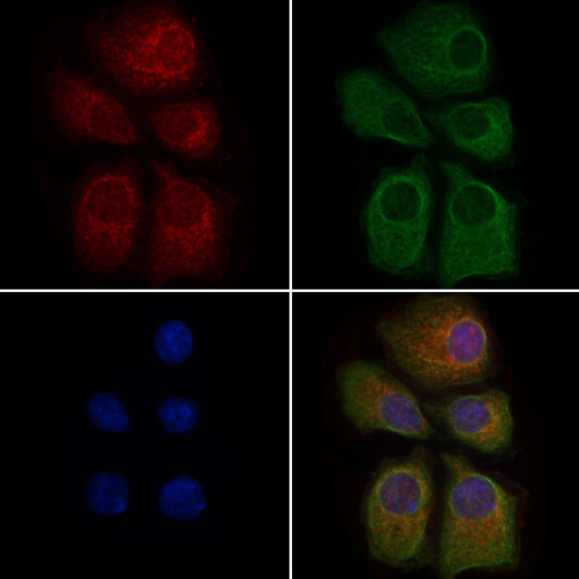MRPL37 Antibody in Immunocytochemistry (ICC/IF)