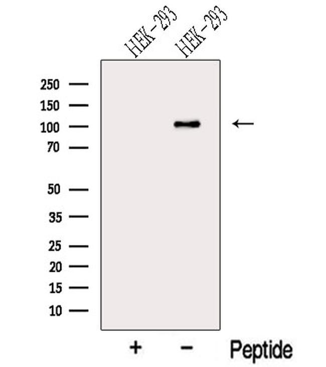 MTHFD1 Antibody in Western Blot (WB)