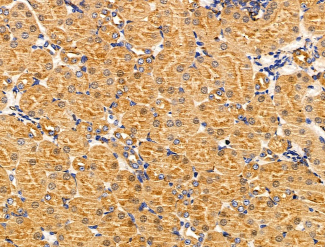 MTR Antibody in Immunohistochemistry (Paraffin) (IHC (P))
