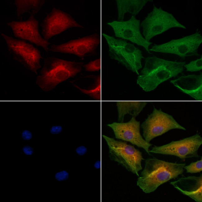 MYBPC3 Antibody in Immunocytochemistry (ICC/IF)