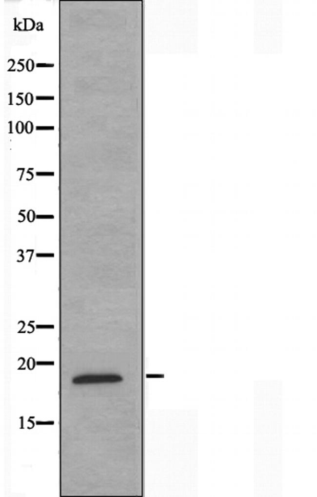 MECOM Antibody in Western Blot (WB)