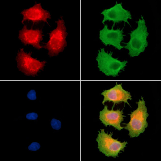MYLK2 Antibody in Immunocytochemistry (ICC/IF)