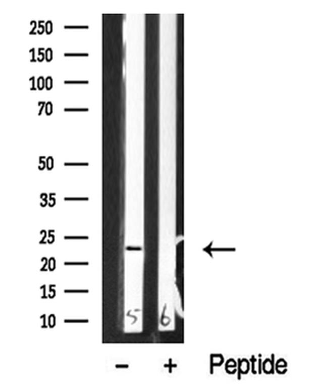 NACA Antibody in Western Blot (WB)