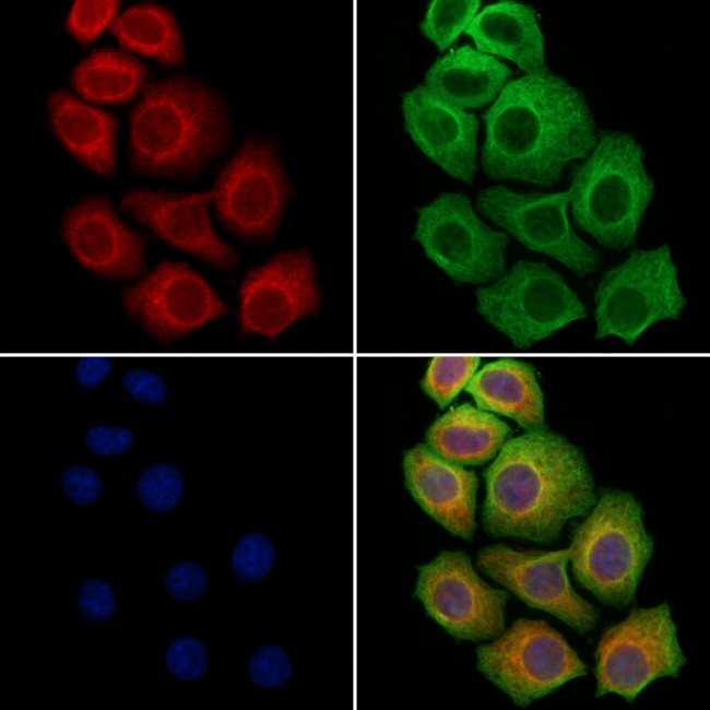 SCN5A Antibody in Immunocytochemistry (ICC/IF)