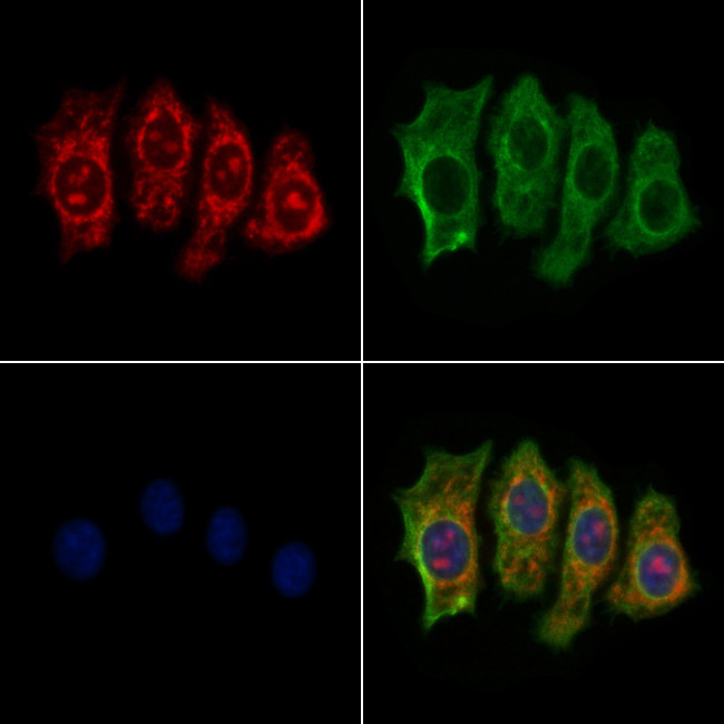 NDUFAF2 Antibody in Immunocytochemistry (ICC/IF)