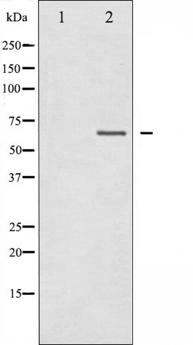 NF2 Antibody in Western Blot (WB)