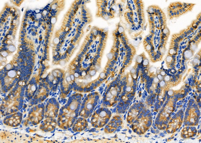 FAM129A Antibody in Immunohistochemistry (Paraffin) (IHC (P))