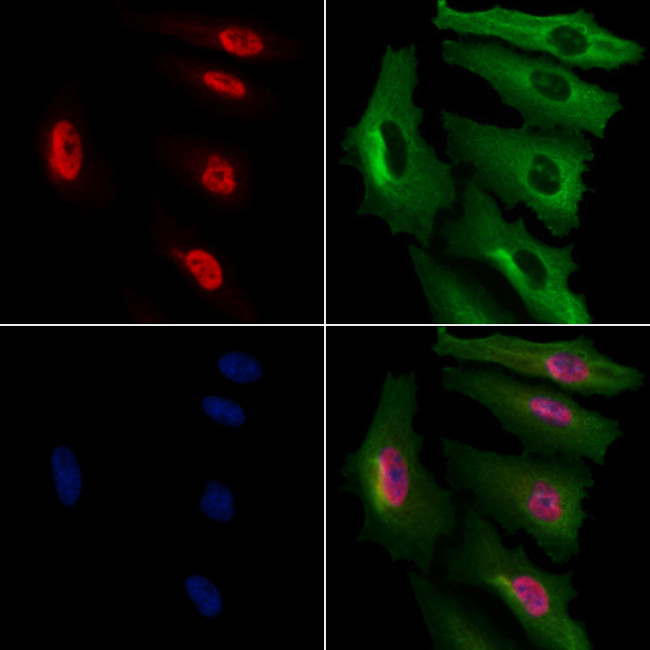 NIP7 Antibody in Immunocytochemistry (ICC/IF)
