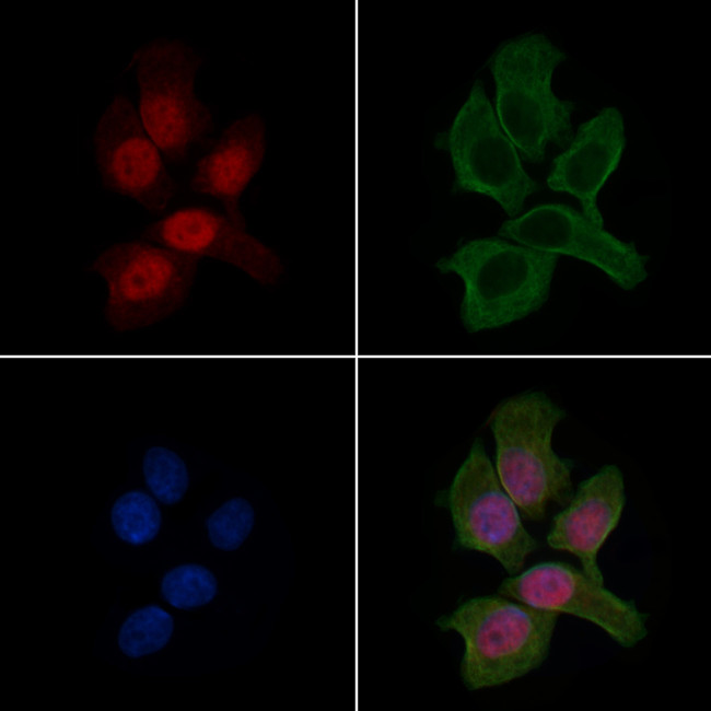 Nkx2.2 Antibody in Immunocytochemistry (ICC/IF)