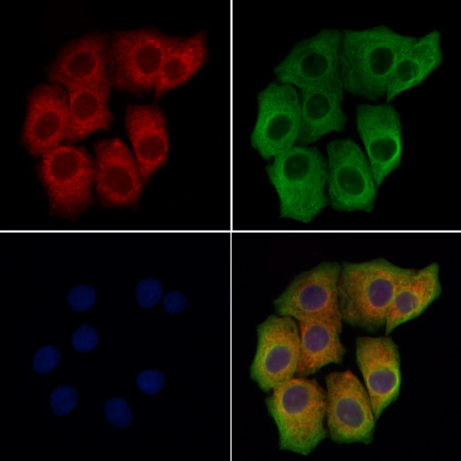 NOD3 Antibody in Immunocytochemistry (ICC/IF)
