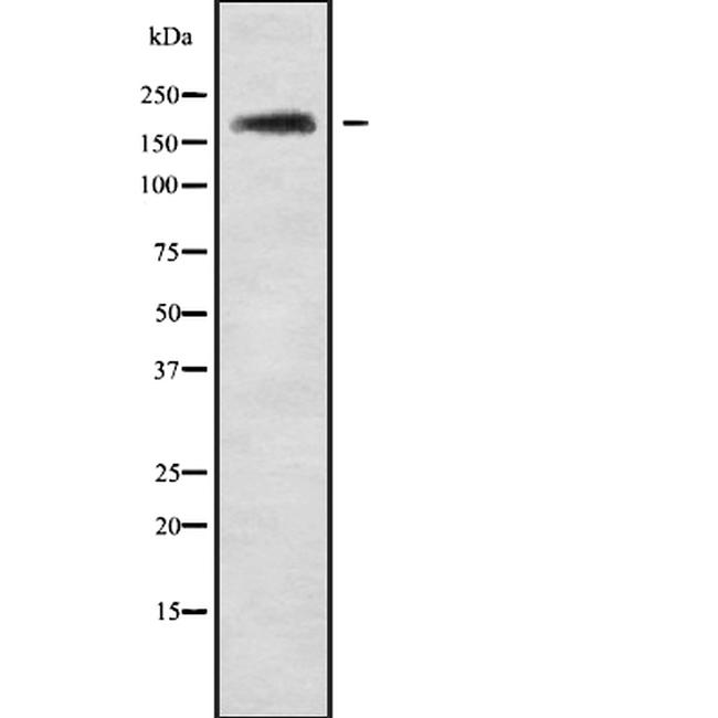 NRXN3 Antibody in Western Blot (WB)
