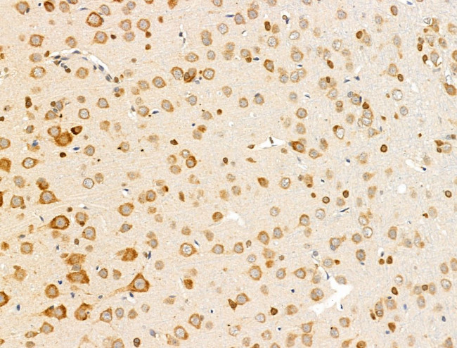 OMP Antibody in Immunohistochemistry (Paraffin) (IHC (P))