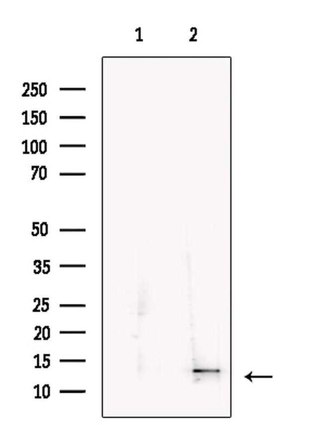 Oncomodulin Antibody in Western Blot (WB)