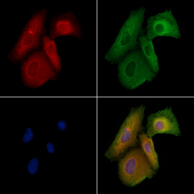 OPA1 Antibody in Immunocytochemistry (ICC/IF)