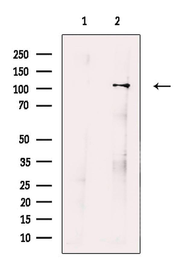 ORP1 Antibody in Western Blot (WB)