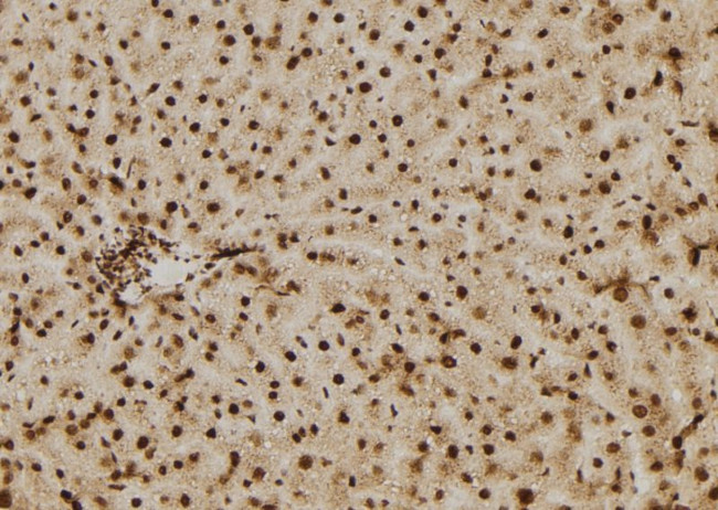 p14ARF Antibody in Immunohistochemistry (Paraffin) (IHC (P))